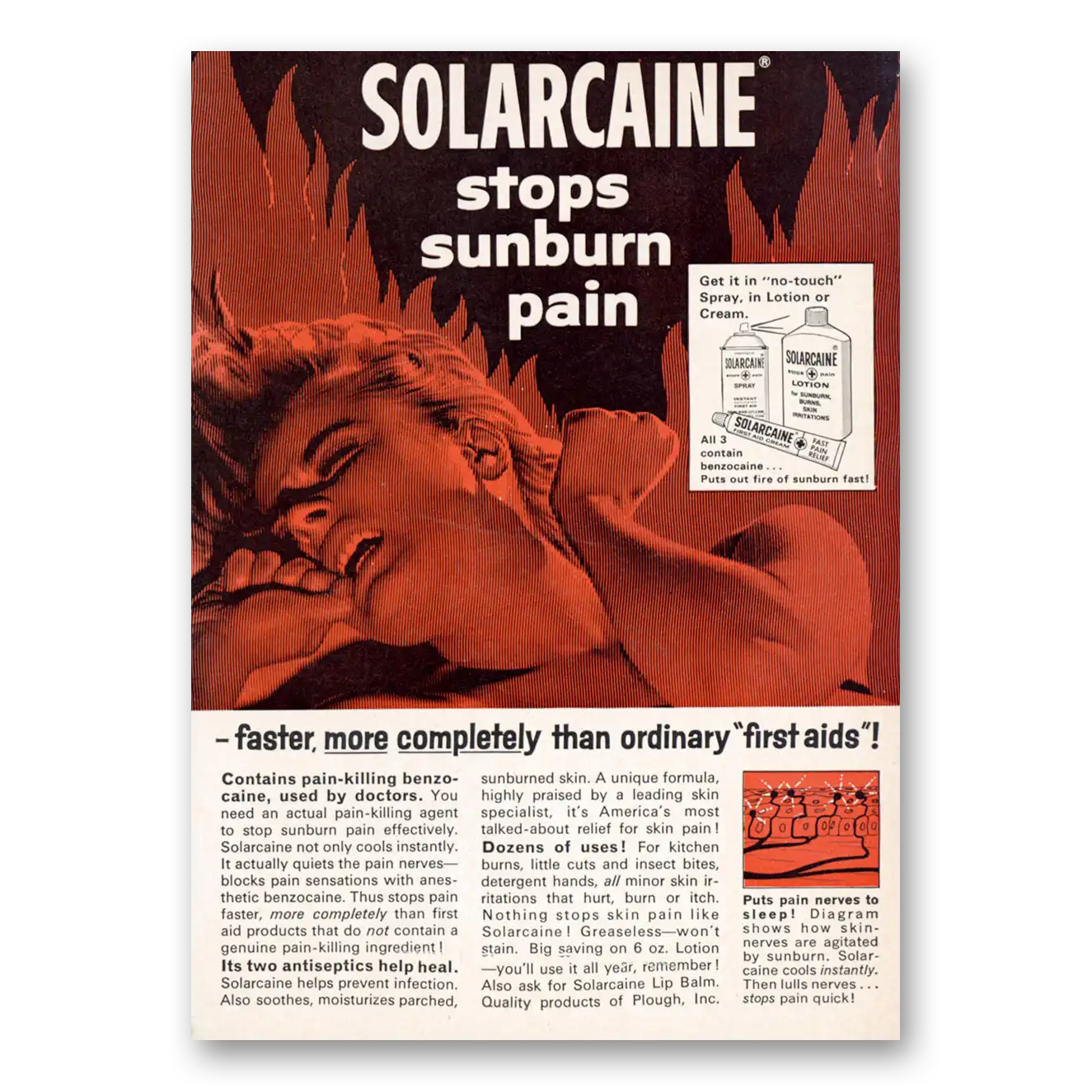 1965 Solarcaine Stops Sunburn Pain Vintage Magazine Print Ad